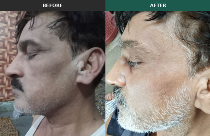 SKINMED UBC - Pakistan First Low Budget Ultra Brightening Cream Made Under SKINMED PHARMA | Only Affordable Low Budget Doctor Formulated Cream In Pakistan
