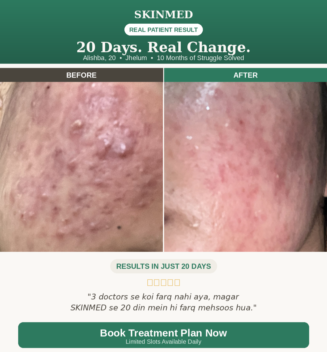 Acne Treatment Plan By SKINMED PHARMA| Dr. Hassaan & Dn. Jaweria