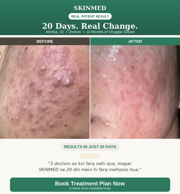Acne Treatment Plan By SKINMED PHARMA| Dr. Hassaan & Dn. Jaweria