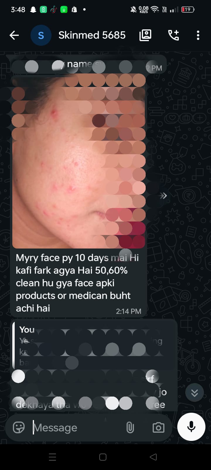 SKINMED Acne Bundle (18% Off) Made Under SKINMED PHARMA | For Oily Acne Prone Highly Sensitive Skin & Combination Skin | Most Gentle Formulation Combo By SKINMED PHARMA - COD & Free Delivery 🚚