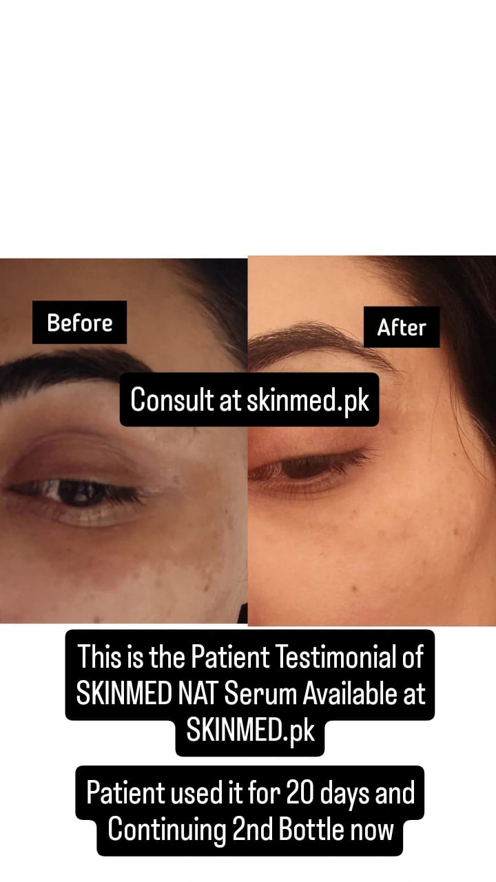SKINMED GFC - Pakistan's First Gentle Skin Cleanser With Modern Formulation Made Under SKINMED PHARMA | Formulated For All Skin Types By Doctors